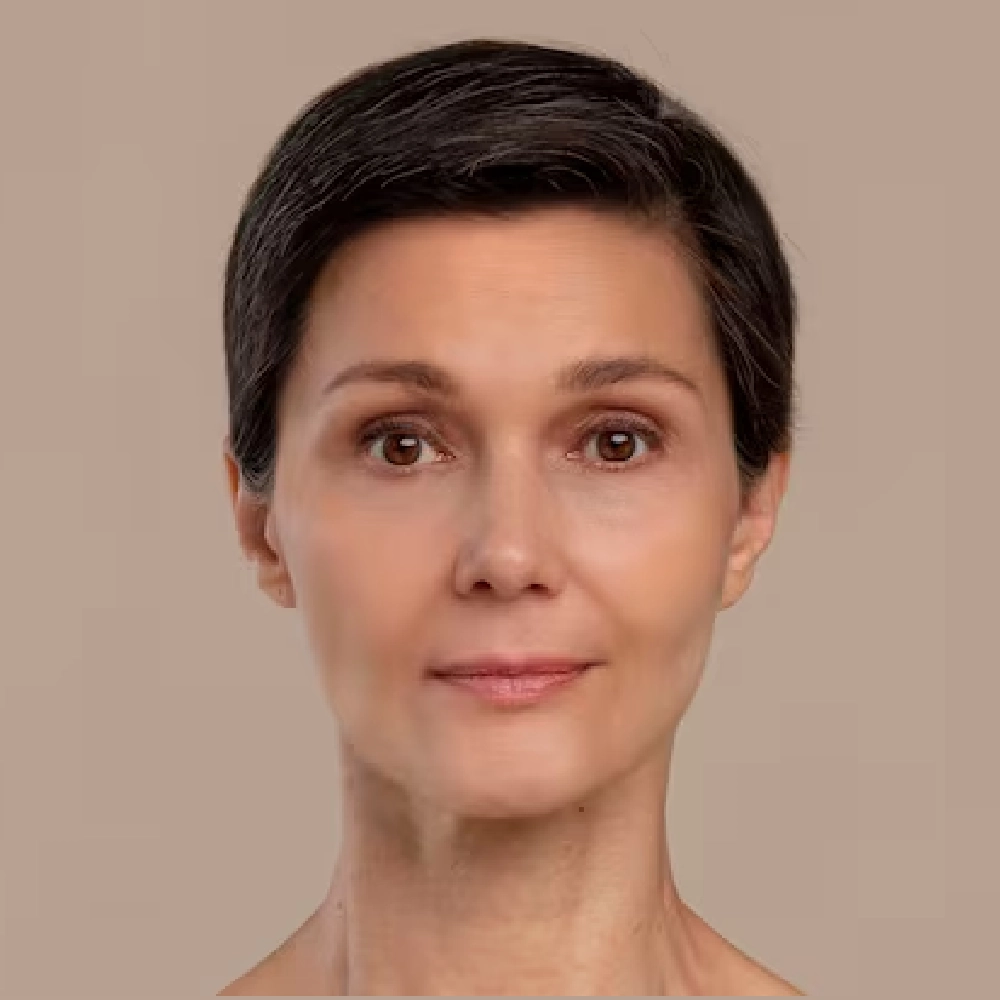 Botox AFTER at The Dental Bar