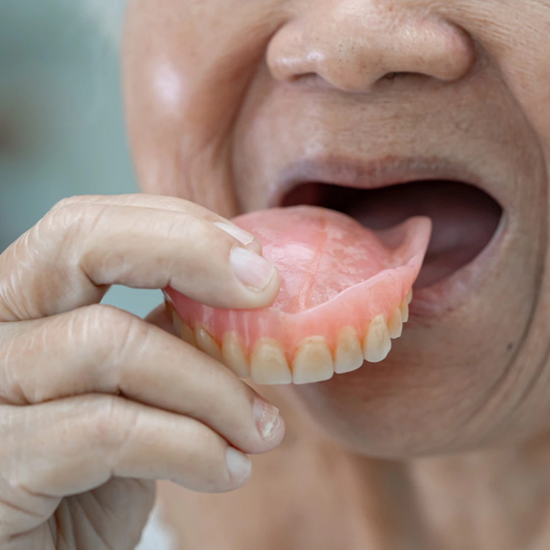 Dentures